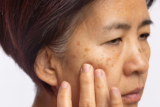 THE DERMA CO. KOJIC COMBO FOR PIGMENTATION & DARK SPOTS