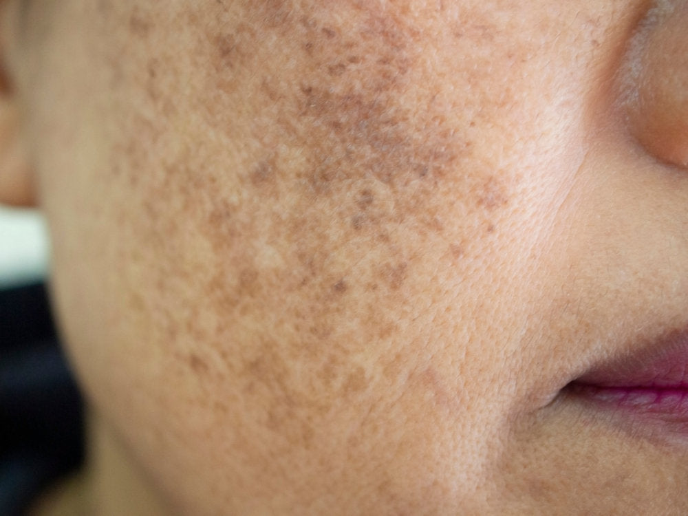 THE DERMA CO. VITAMIN-C COMBO FOR PIGMENTATION