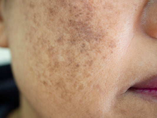 THE DERMA CO. VITAMIN-C COMBO FOR PIGMENTATION
