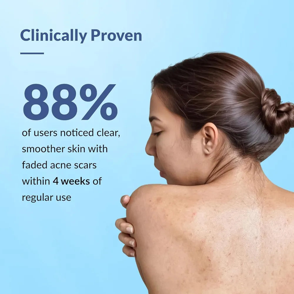 Fixderma Salyzap Anti-Acne Body Wash – Clears Body Acne & Unclogs Pores