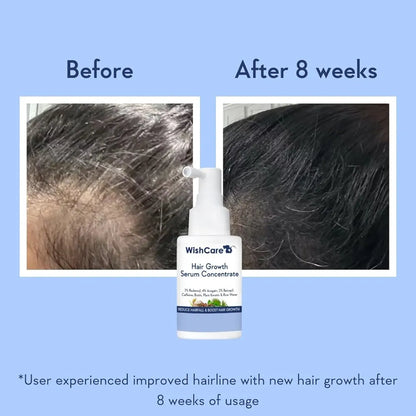 WishCare Hair Growth Booster Serum