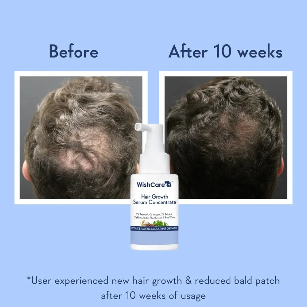 WishCare Hair Growth Booster Serum