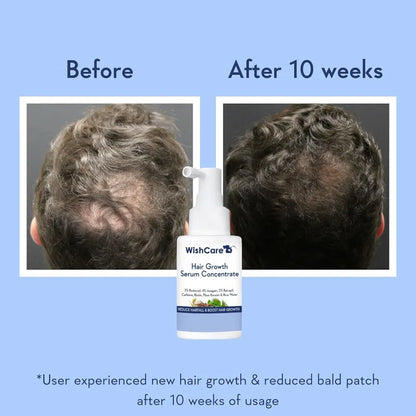 WishCare Hair Growth Booster Serum